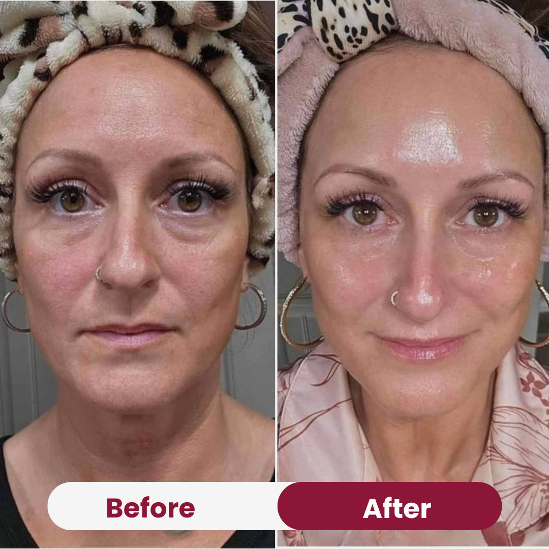 Ultra Glow Collagen Mask™