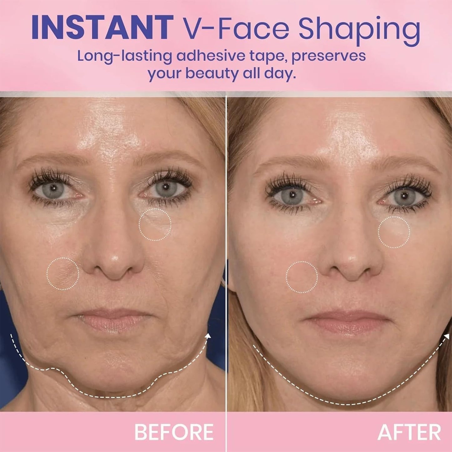 Invisible Instant Face Lift™