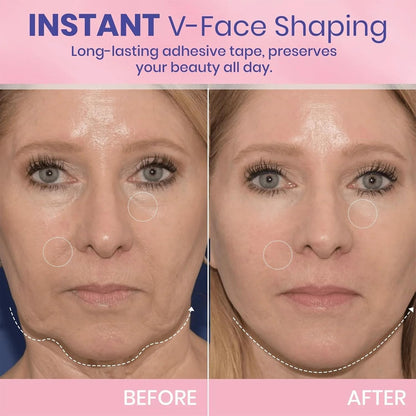 Invisible Instant Face Lift™